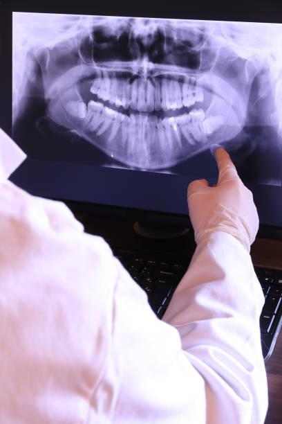 Best Emergency Broken Tooth Repair in River Falls, WI