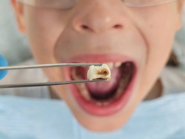 Fast & Reliable Emergency Dental Services in WI